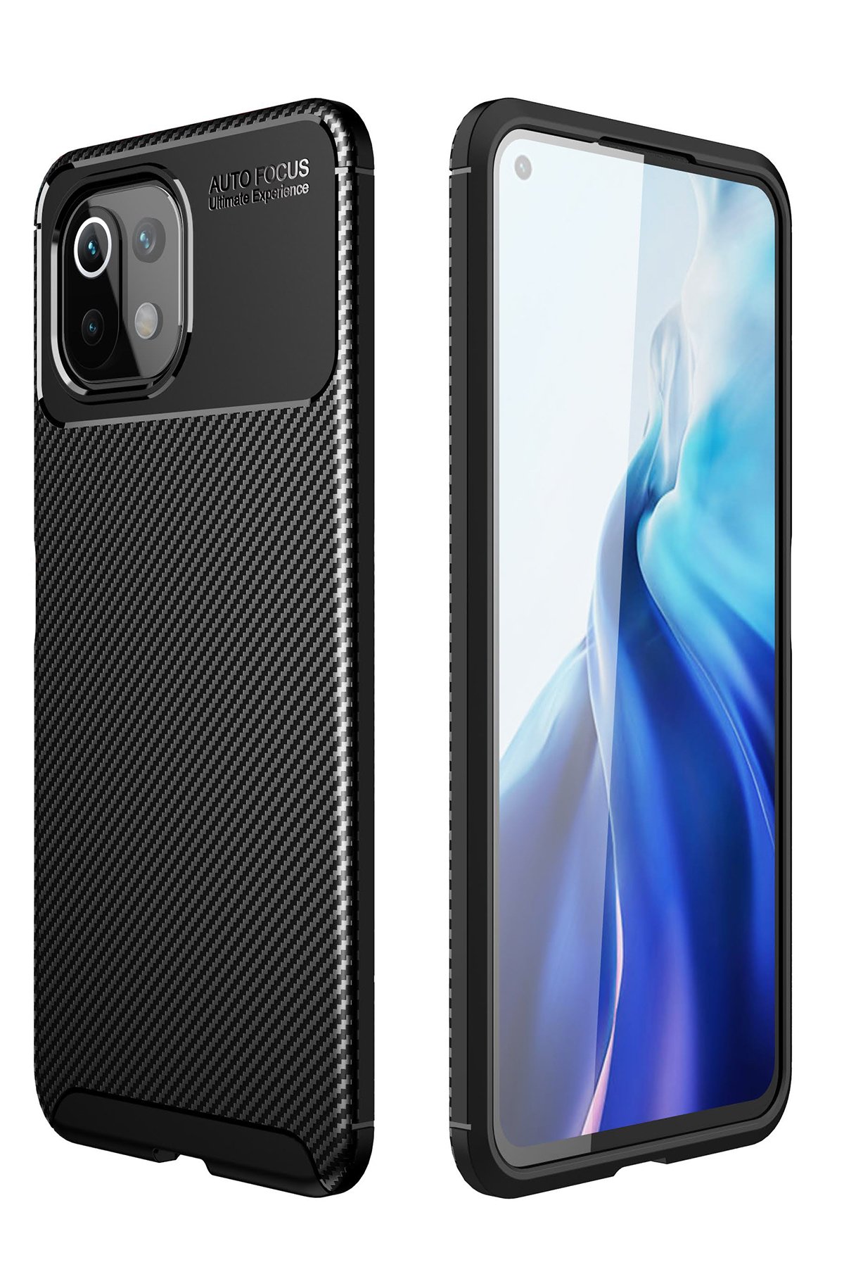 Newface Xiaomi Mİ 11 Lite Kılıf Zuma Kartvizitli Yüzüklü Silikon - Lila