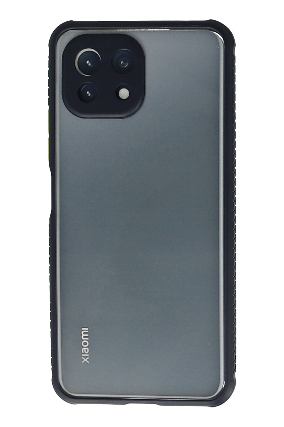 Newface Xiaomi Mİ 11 Lite Kılıf Sofya Yüzüklü Silikon Kapak - Lacivert