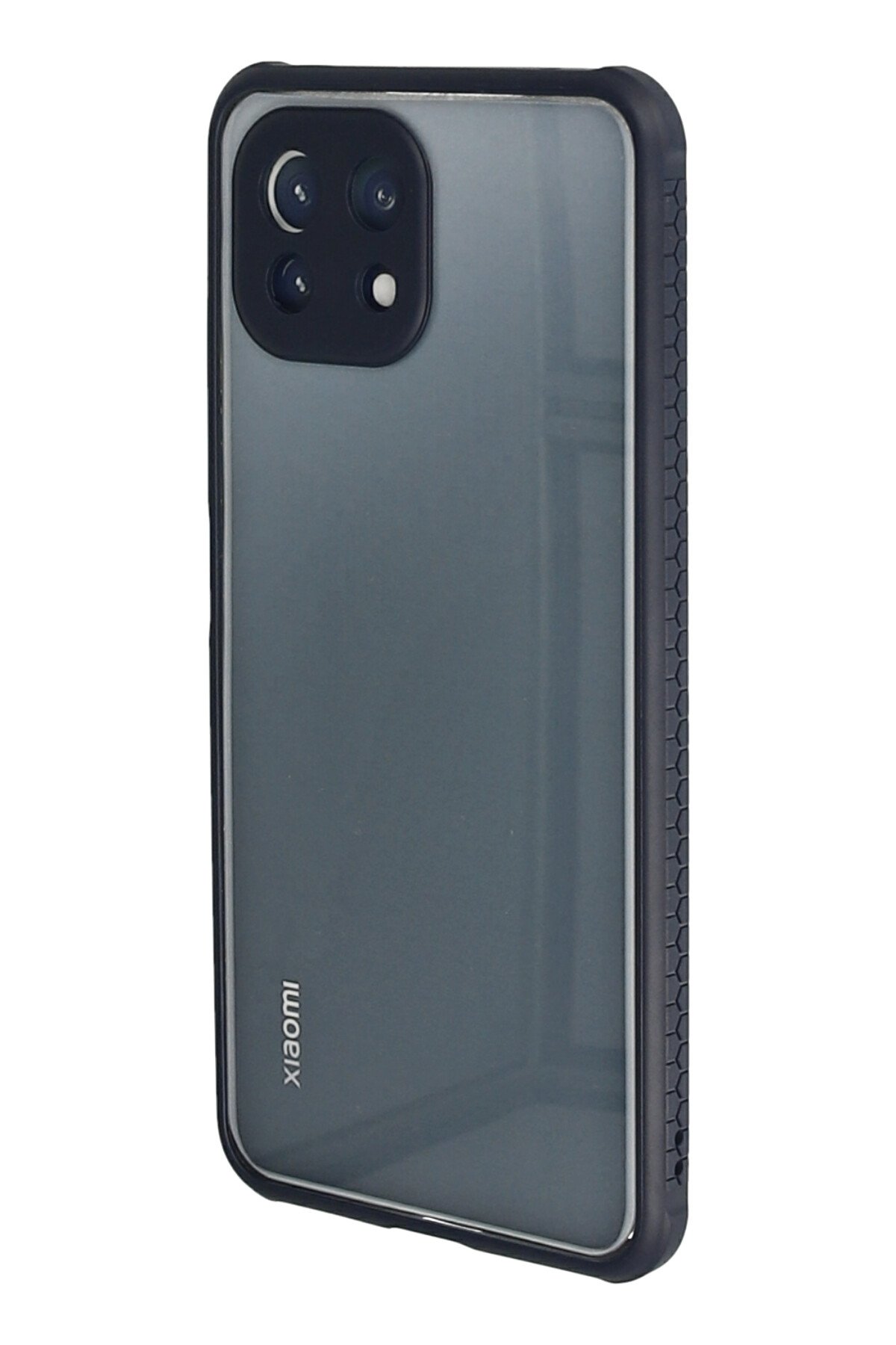 Newface Xiaomi Mİ 11 Lite Kılıf Sofya Yüzüklü Silikon Kapak - Lacivert