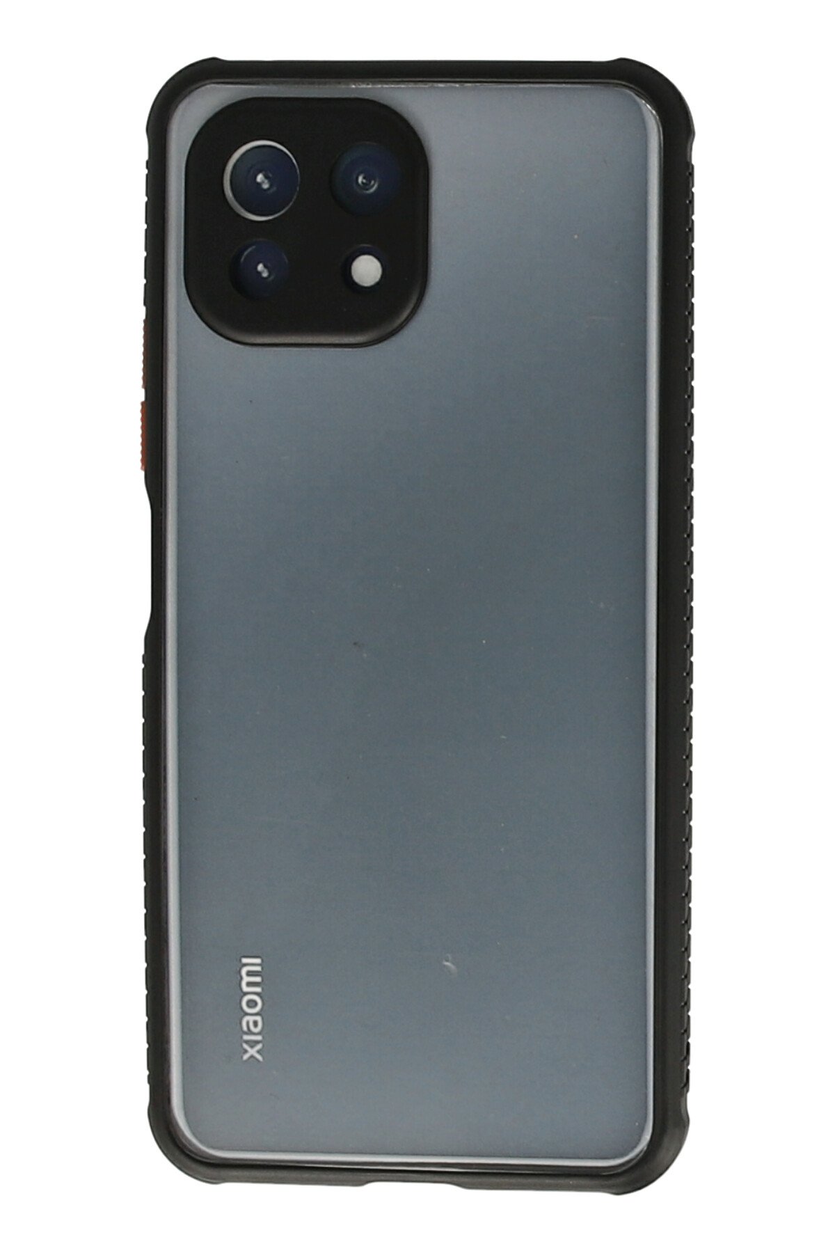Newface Xiaomi Mİ 11 Lite Kılıf Elit Yüzüklü Kapak - Siyah