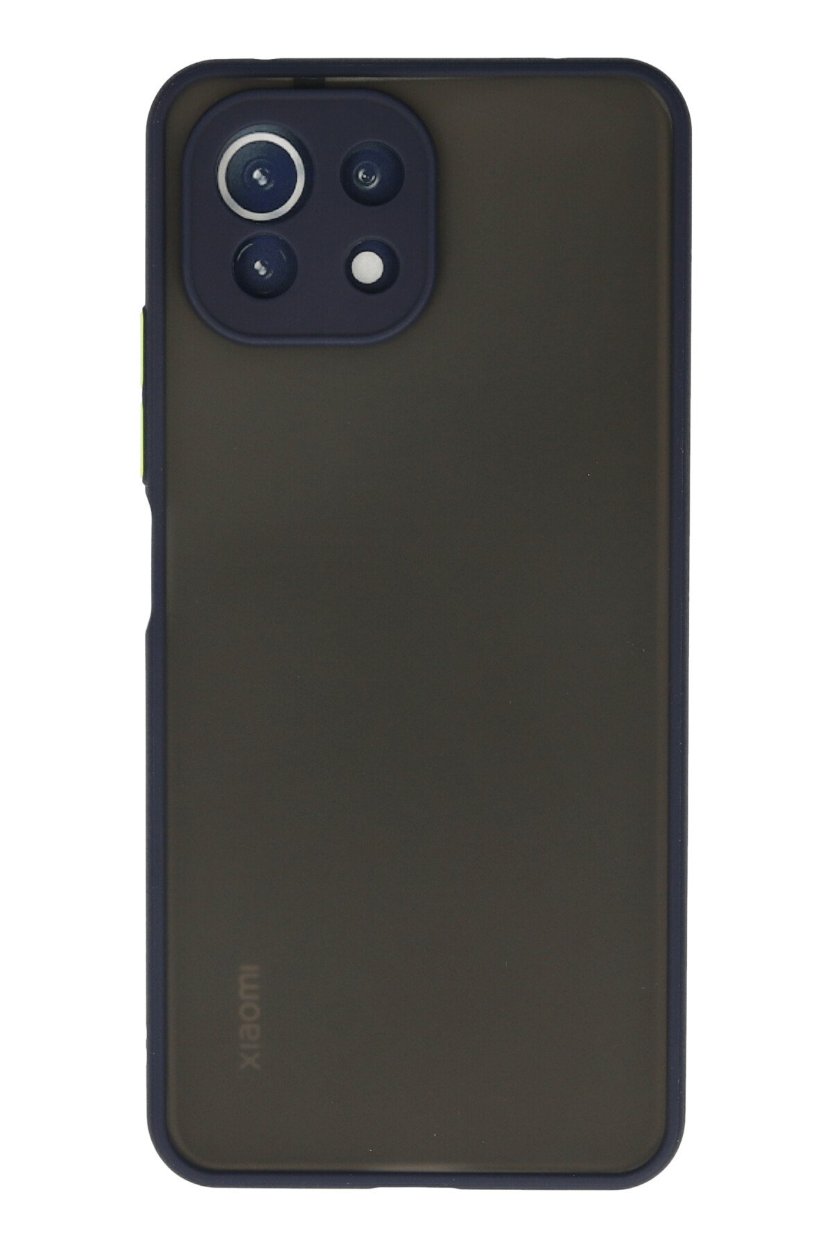 Newface Xiaomi Mİ 11 Lite Kılıf Platin Silikon - Lacivert