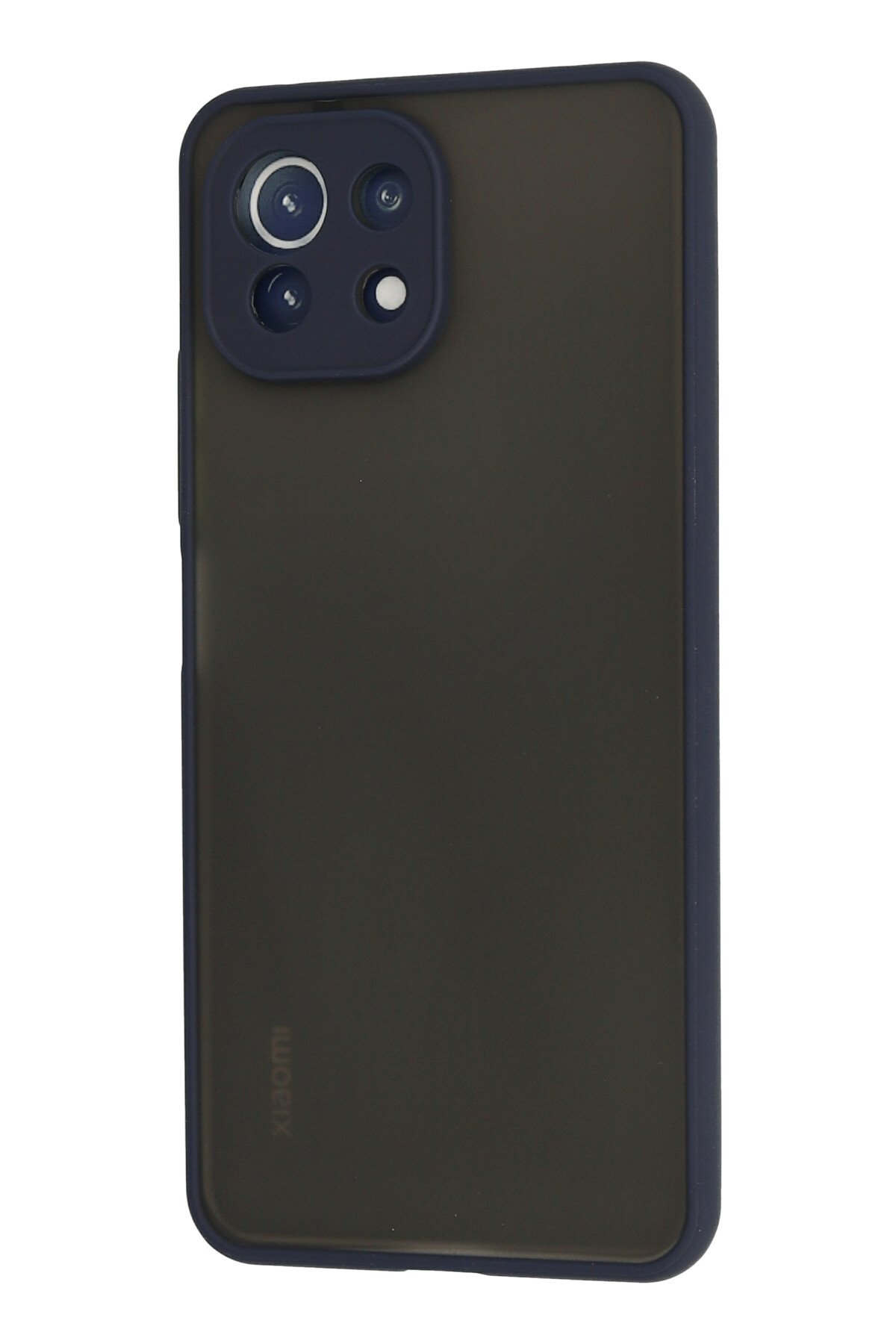 Newface Xiaomi Mİ 11 Lite Kılıf Platin Silikon - Lacivert