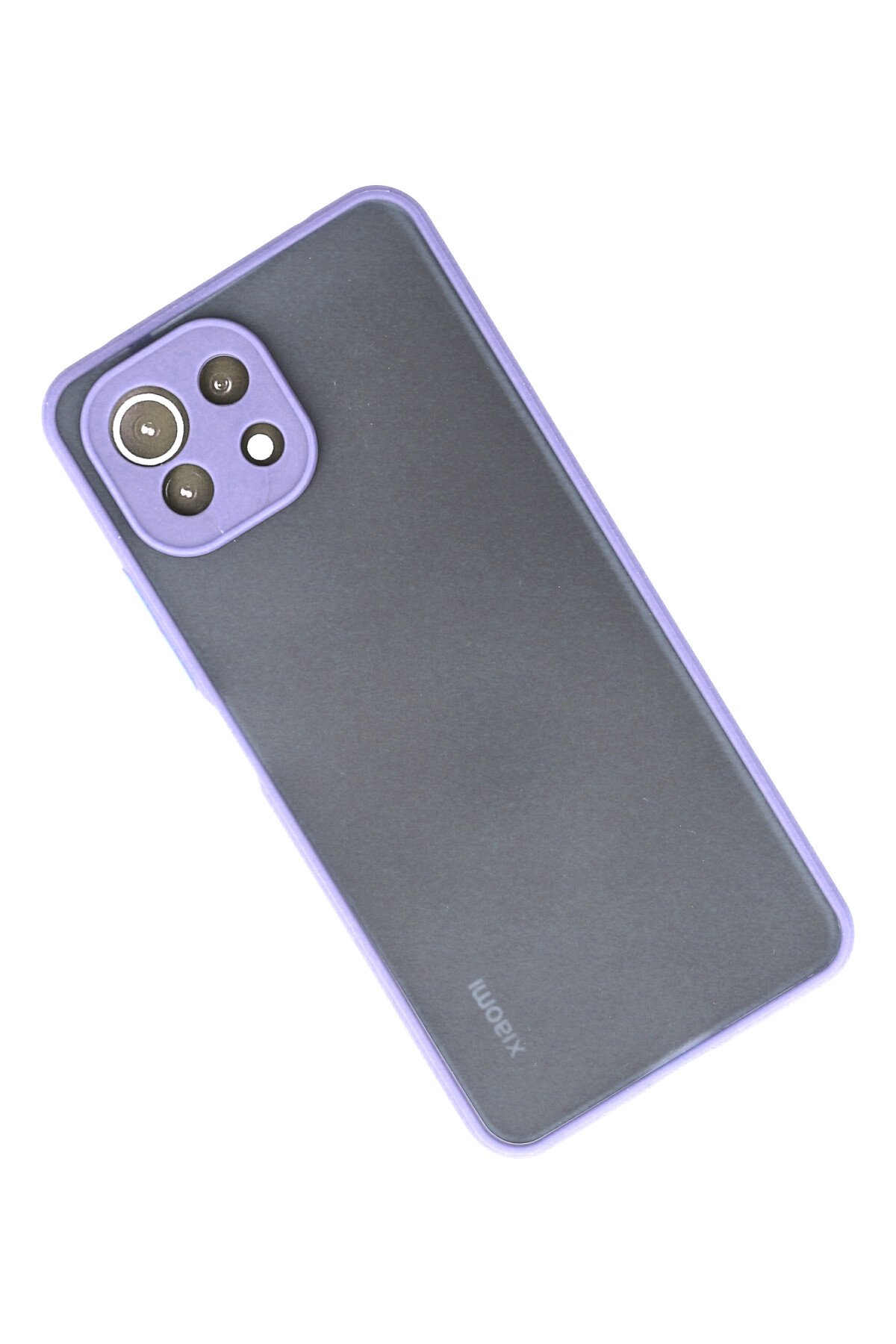 Newface Xiaomi Mİ 11 Lite Kılıf Color Lens Silikon - Siyah