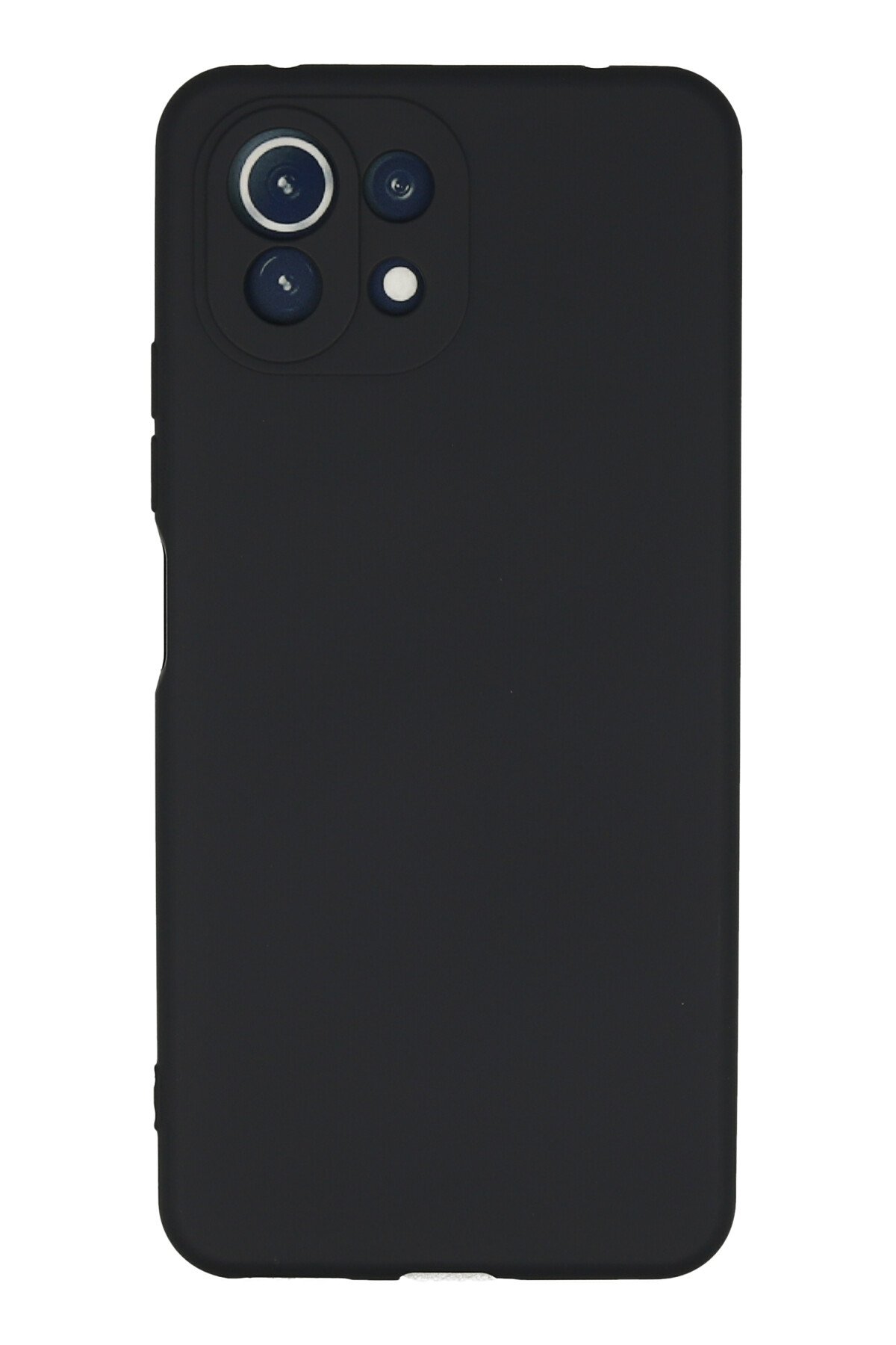 Newface Xiaomi Mİ 11 Lite Kılıf Platin Silikon - Siyah