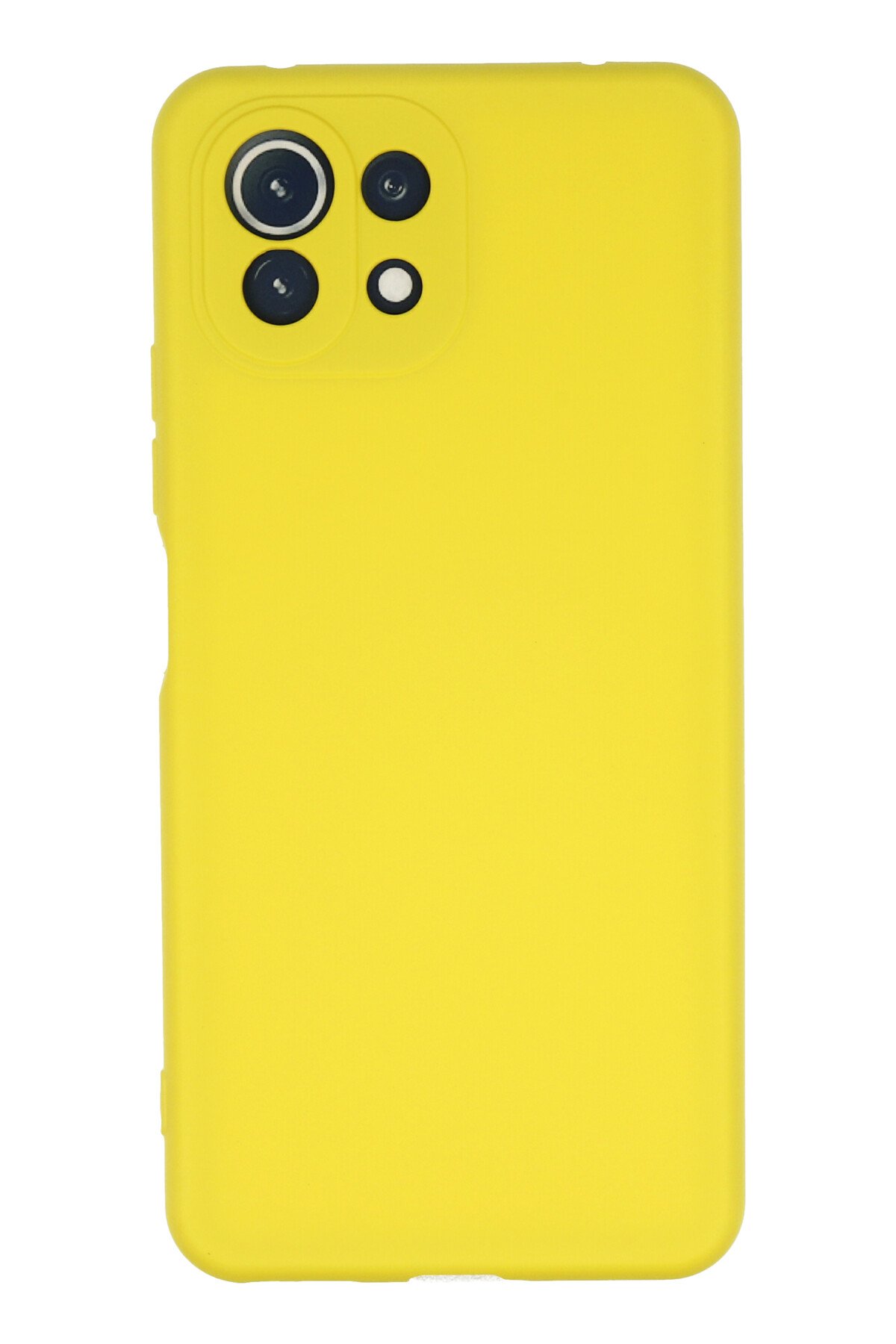 Newface Xiaomi Mİ 11 Lite Kılıf Pars Lens Yüzüklü Silikon - Lacivert