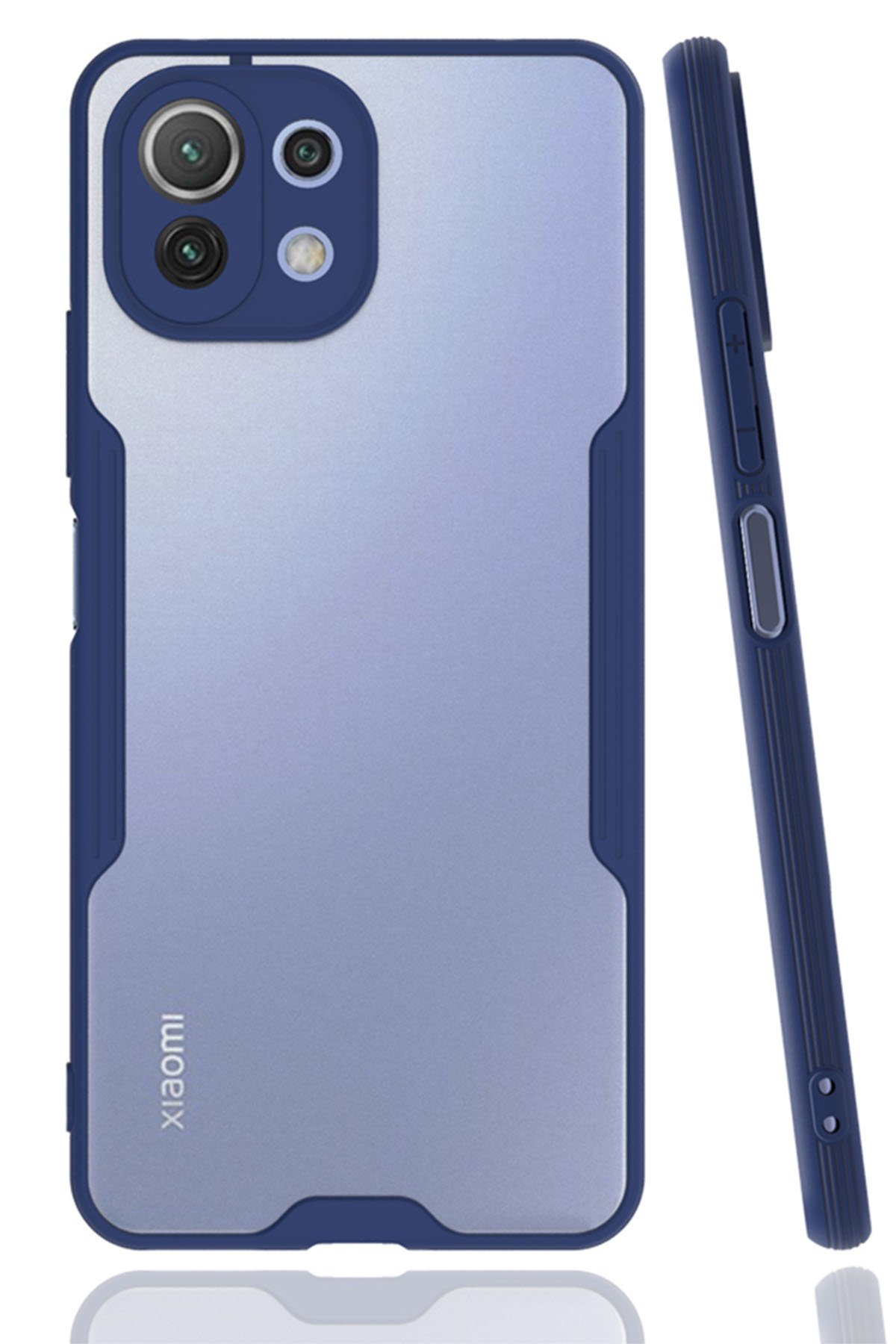 Newface Xiaomi Mİ 11 Lite Kılıf Zuma Kartvizitli Yüzüklü Silikon - Pembe