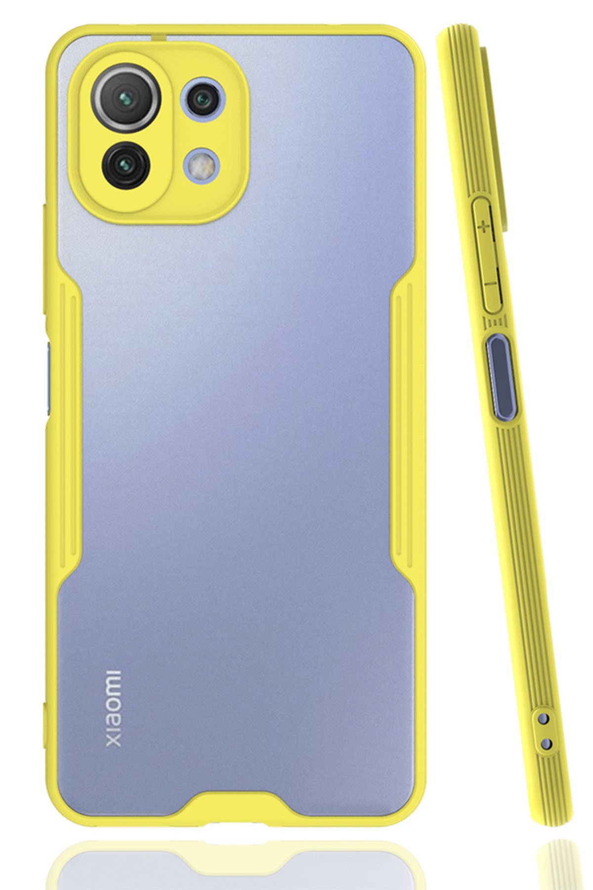 Newface Xiaomi Mİ 11 Lite Kılıf Sofya Yüzüklü Silikon Kapak - Siyah