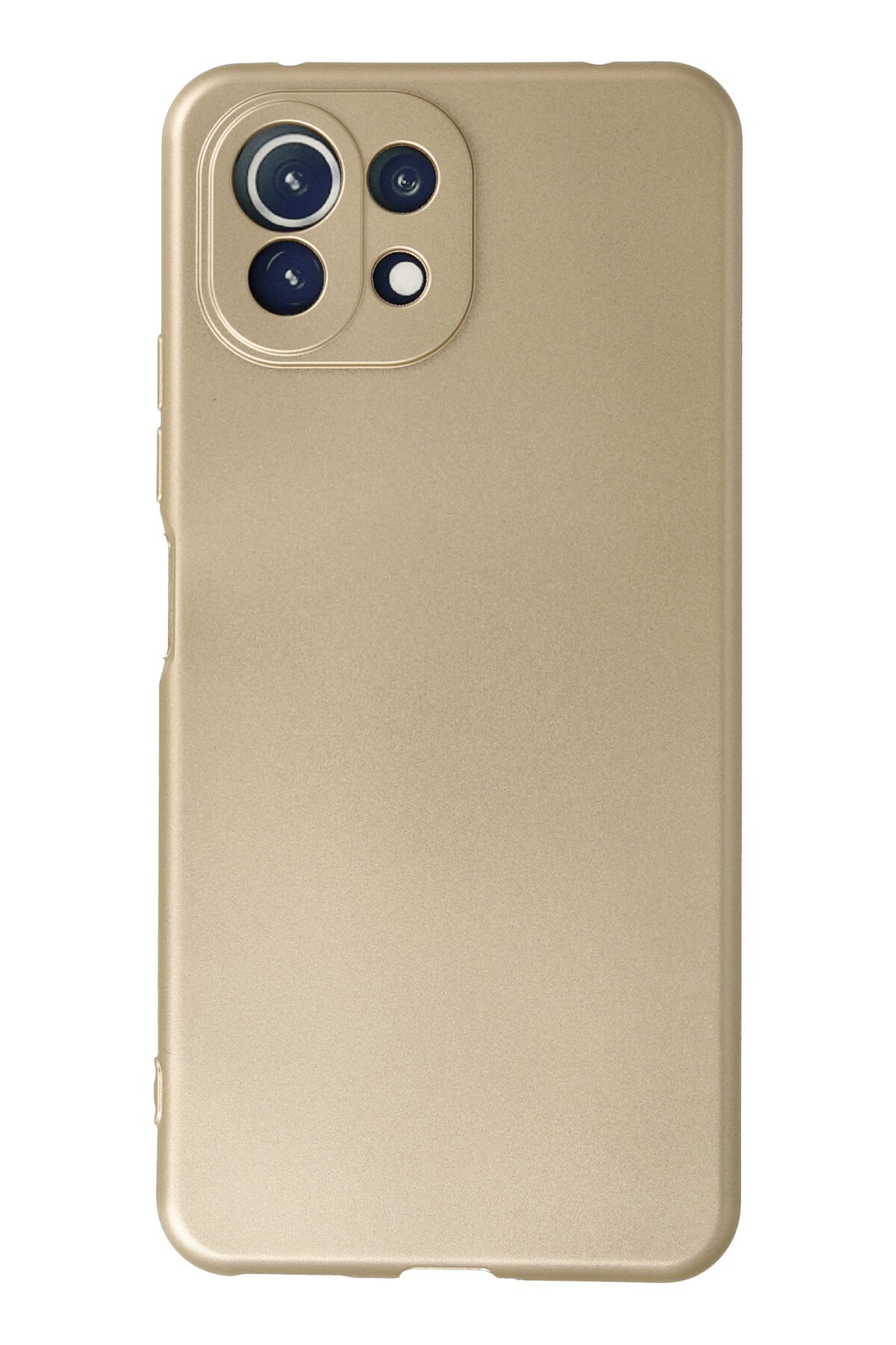 Newface Xiaomi Mİ 11 Lite Kılıf Pars Lens Yüzüklü Silikon - Kırmızı
