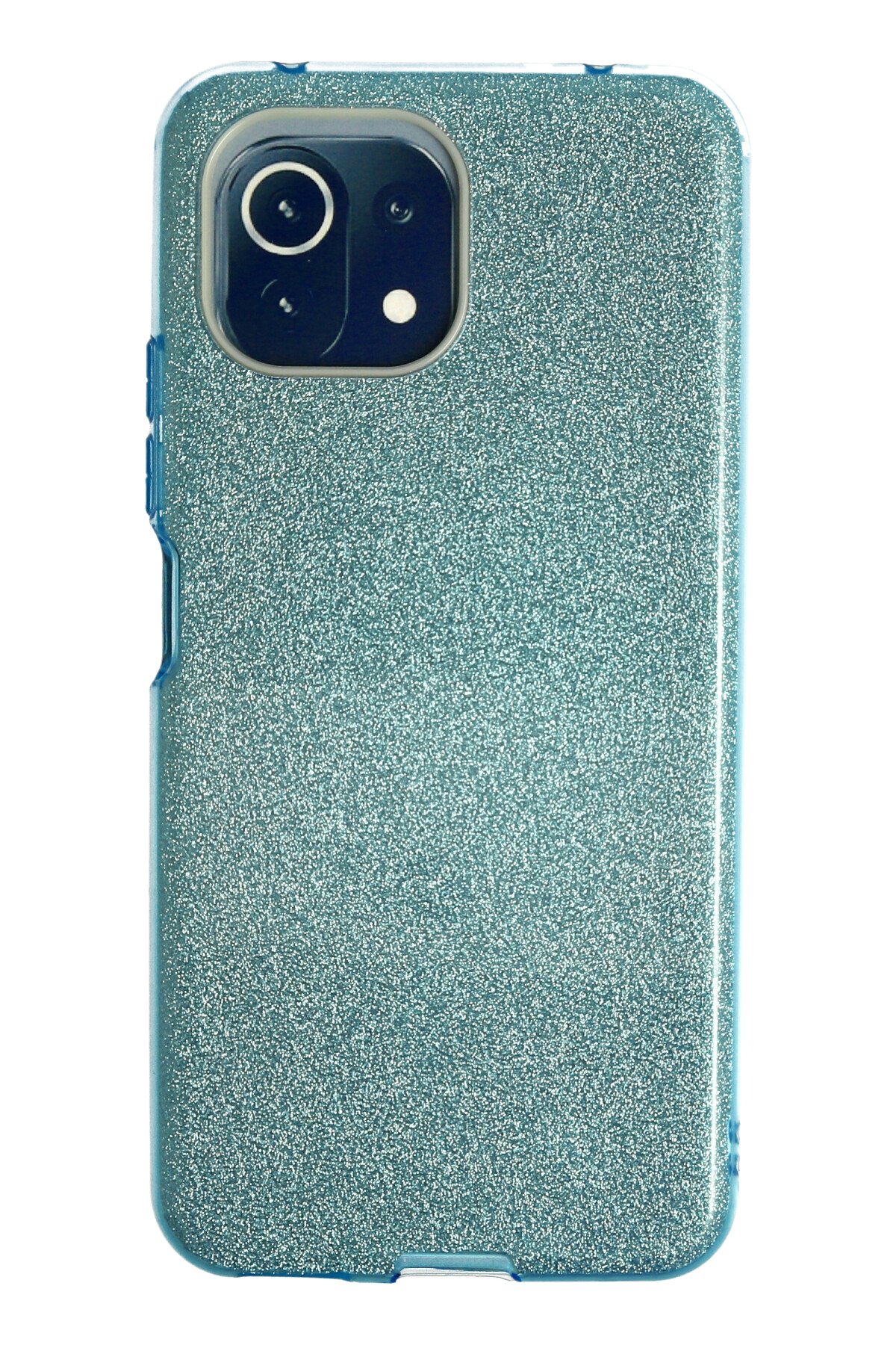 Newface Xiaomi Mİ 11 Lite Kılıf Color Lens Silikon - Kırmızı