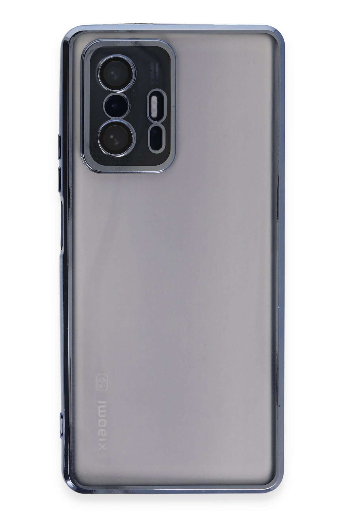 Newface Xiaomi Mi 11T Kılıf Pars Lens Yüzüklü Silikon - Gold