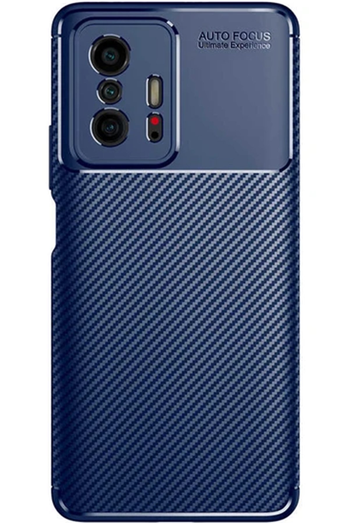 Newface Xiaomi Mi 11T Pro Kılıf Mirror Desenli Kapak - Mirror - 11