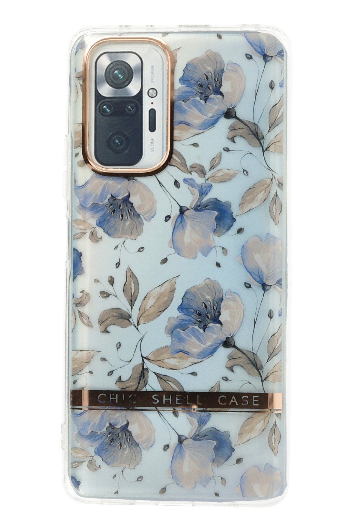 Newface Xiaomi Redmi Note 10 Pro Kılıf Platin Kamera Koruma Silikon - Sarı