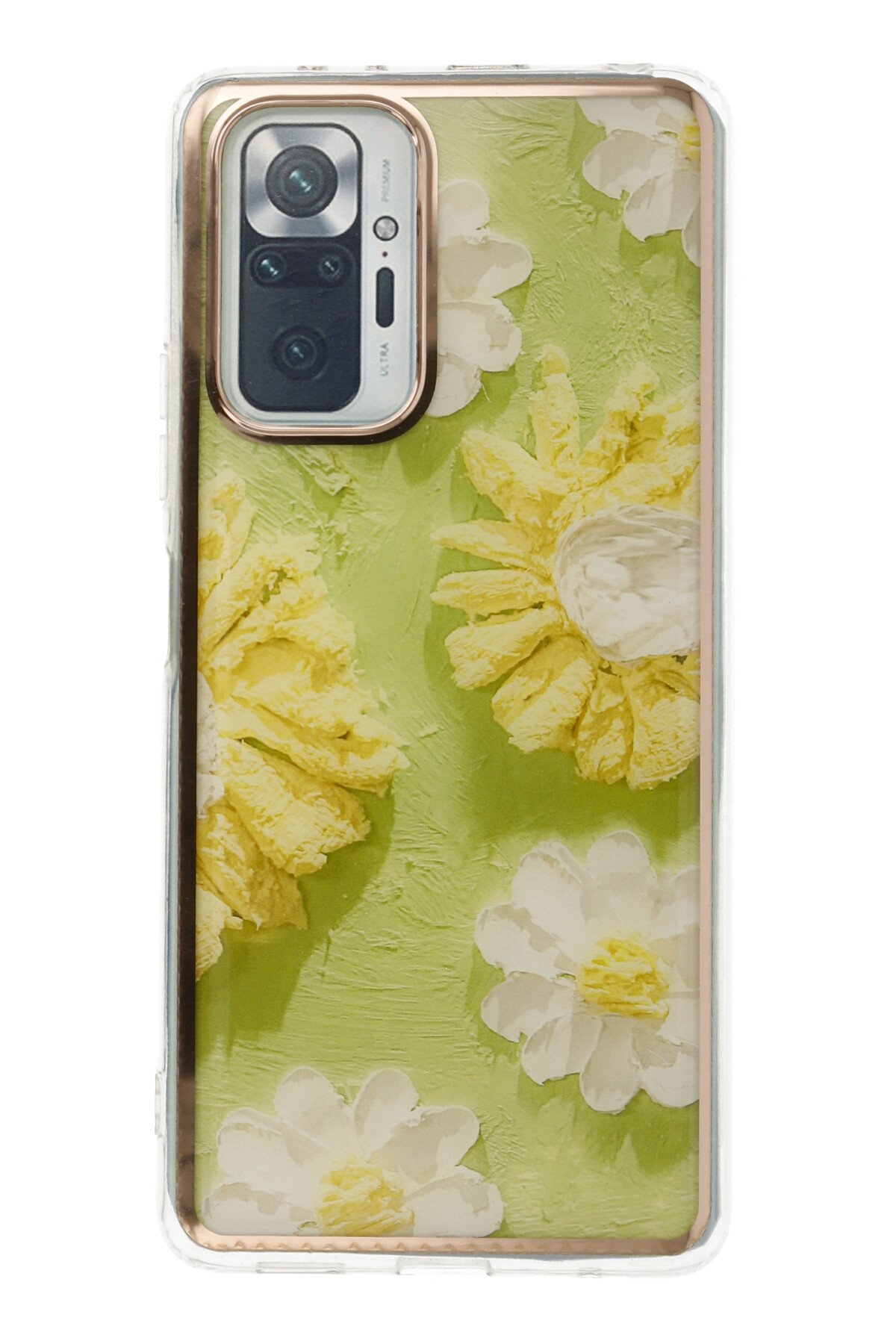 Newface Xiaomi Redmi Note 10 Pro Kılıf Razer Lensli Silikon - Yeşil