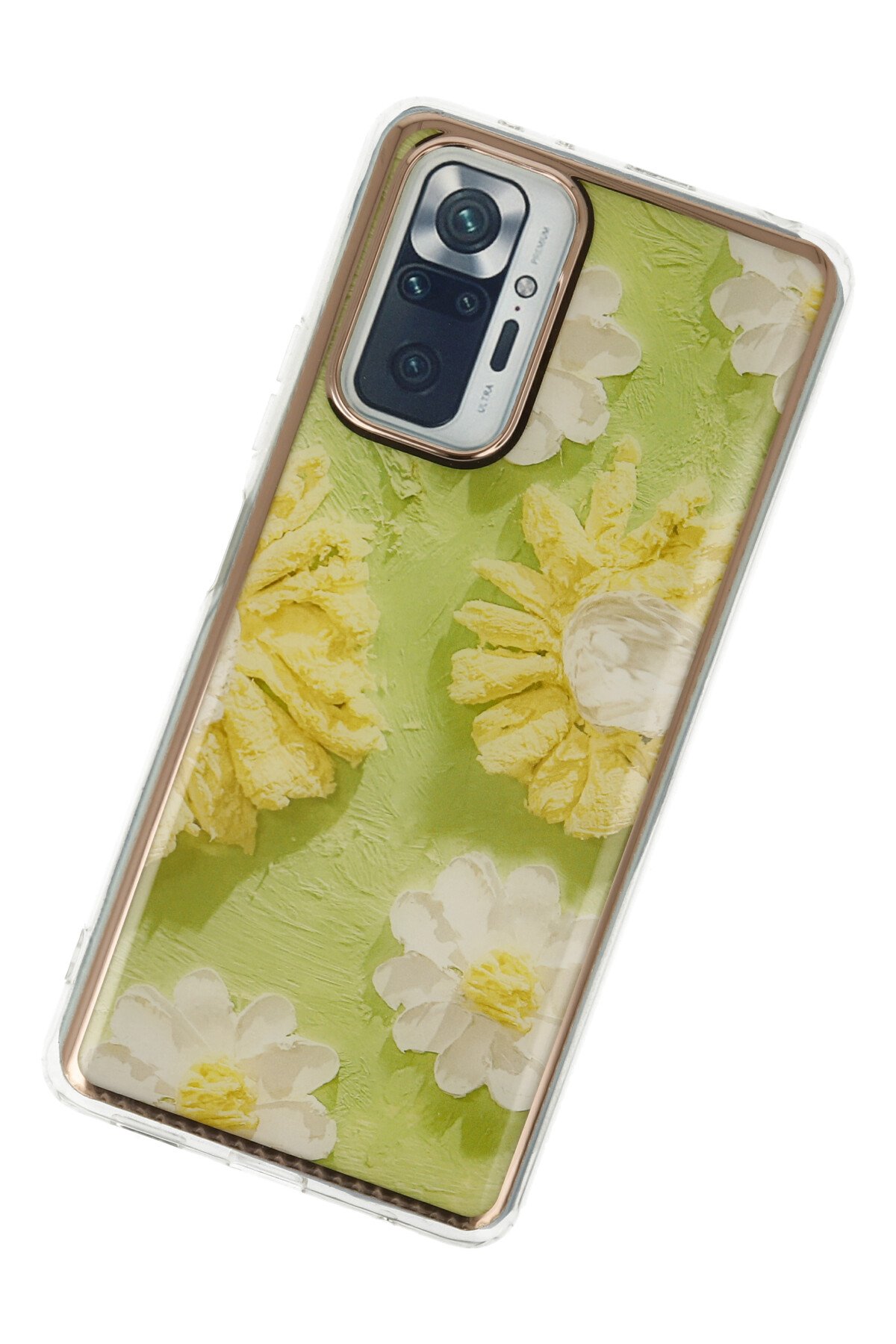 Newface Xiaomi Redmi Note 10 Pro Kılıf Razer Lensli Silikon - Yeşil